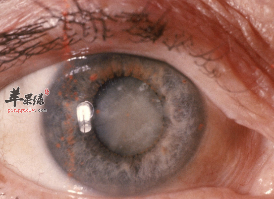 能改善老年人白内障的食疗方法  第3张
