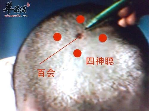 春季防春困有哪些按摩方法  第1张