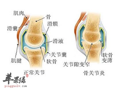 冬季如何防治关节疾病